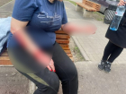 В Новочеркасске собака накинулась на женщину на детской площадке