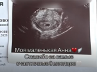 Перинатальный центр Ростова опровергает слухи о смерти ребенка из-за акушерского поворота