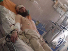 Выживший при захвате ростовского СИЗО террорист Даниил Каменев пришел в сознание