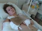 23-летнюю девушку, оставшуюся без руки и ноги после взрыва в Донецке, доставили в Ростов