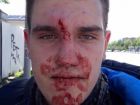 Разгневанный автолюбитель жестоко избил притормозившего у ямы байкера на дороге Ростова