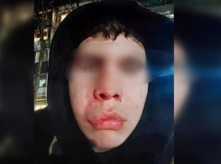 «Он с другом подрался»: информацию о нападении на подростка опровергли в ростовском следкоме