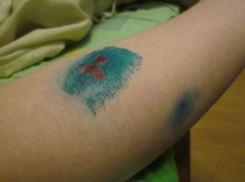 Стая бродячих собак искусала школьника на глазах его отца в Ростове 