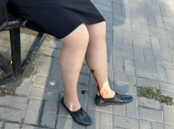 В Азове бродячая собака напала и искусала на женщину