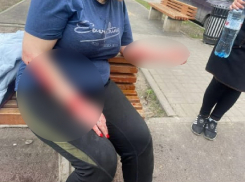 В Новочеркасске поймали собаку, которая разодрала женщине руки на детской площадке