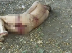 Страшная и мучительная смерть от бутылки в заднем проходе настигла жителя Ростова