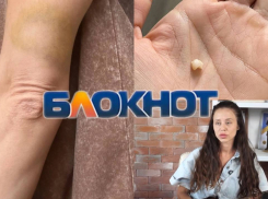 «Приехала домой, а попала в ад»: бывший муж душил и избил ростовчанку прямо в фитнес-клубе