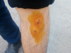 Злобный пес нанес рваные раны мужчине на авторынке в Ростове