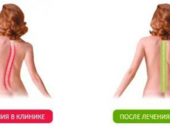 Все проблемы от позвоночника. Специалисты клиники доктора Бобыря проведут приём в Ростове