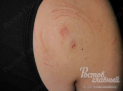 Неизвестное животное напало на ростовчанку во время отдыха на пляже города   