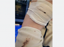 Пытались вцепиться в горло: стая собак едва не загрызла молодую девушку возле администрации донского города