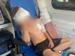 В полиции прокомментировали нападение волка на мальчика на Дону