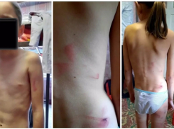 В Шахтах в «показательной семье» приемных детей избивали за «лишнюю» еду