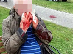 Участники гаражного кооператива жестоко избили своего председателя во время собрания в Ростове