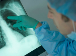 Заболевший гриппом мужчина умер от пневмонии в Ростовской области