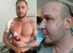 На трехкратного чемпиона России возбудили дело после того, как сосед сломал ему плечи в Батайске       