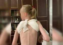10-летний самокатчик сбил 7-летнюю девочку и сломал ей ключицу в Батайске