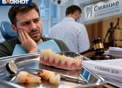 После протезирования пришлось удалить зубы: в Ростове пациент судится со стоматологом