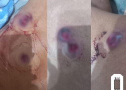 Под Ростовом неизвестные избили и расстреляли из травмата участника СВО