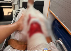 Концерт Ольги Бузовой в Ростове могут отменить из-за серьезной травмы артистки