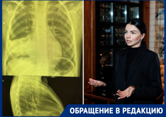 В Ростове у маленькой девочки в частной медицинской клинике не заметили пневмонию