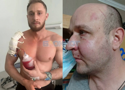 На трехкратного чемпиона России возбудили дело после того, как сосед сломал ему плечи в Батайске       