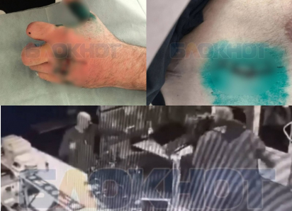 В Ростове неизвестный расстрелял и порезал охрану клуба после того, как его не пустили внутрь