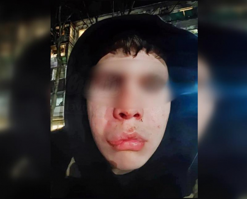 Неизвестный избил подростка ради денег в Ростове