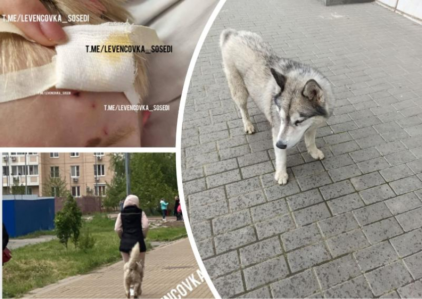 В Ростове в Левенцовке собака укусила четырехлетнего ребенка за лицо