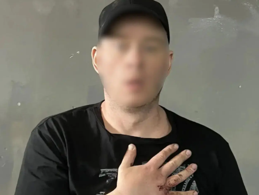 В Ростове мужчина повредил чужую машину и не смог объяснить свой поступок