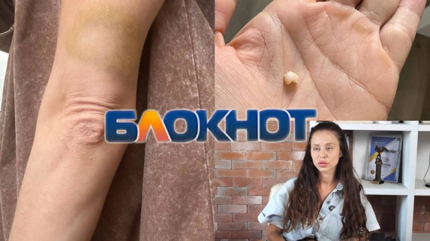 «Приехала домой, а попала в ад»: бывший муж душил и избил ростовчанку прямо в фитнес-клубе