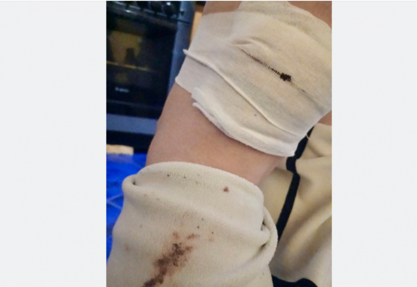 Пытались вцепиться в горло: стая собак едва не загрызла молодую девушку возле администрации донского города