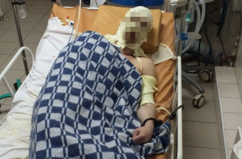 Ревнивец, поджегший любимую, скончался в ростовской больнице