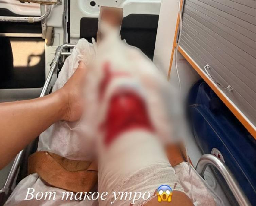 Концерт Ольги Бузовой в Ростове могут отменить из-за серьезной травмы артистки
