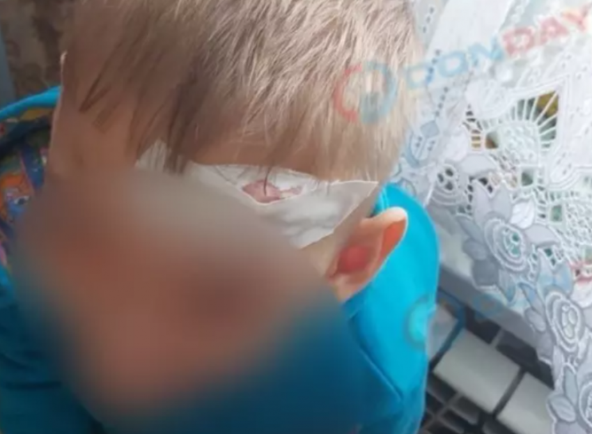 «Везли с дыркой во лбу»: в донском городе ребёнку с пробитой головой не смогли помочь из-за отсутствия хирурга